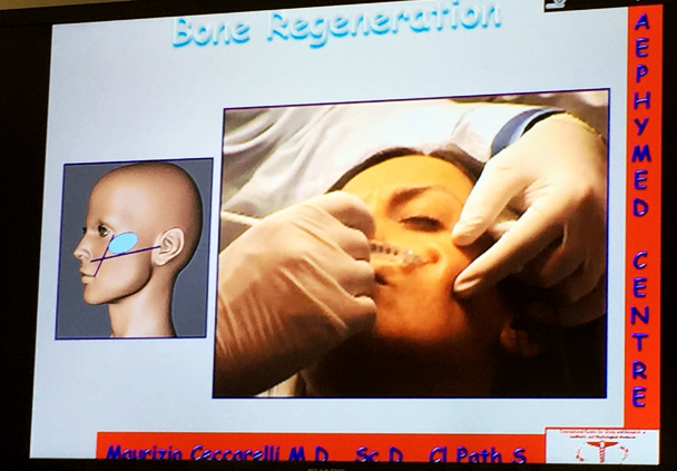 ceccarelli regeneration